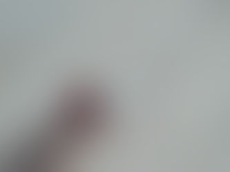 Is Approval Your Default Position?